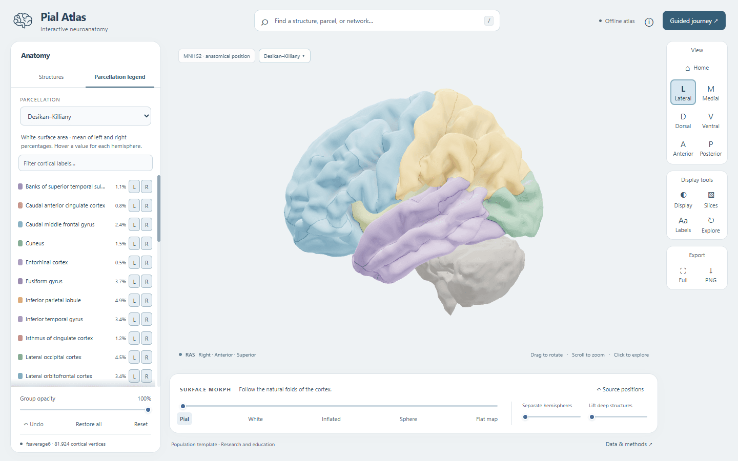 Pial Atlas showing the left lateral cortex coloured by Desikan-Killiany parcels