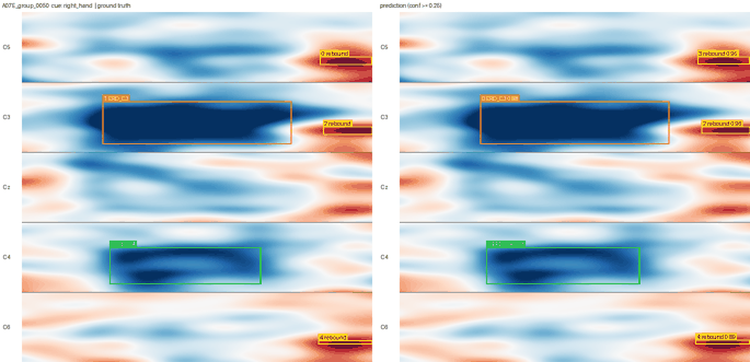 Ground truth and YOLO11 detections of ERD and beta rebound boxes on stacked EEG spectrograms